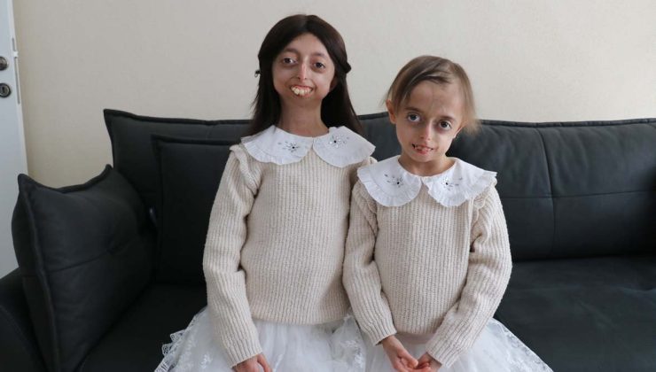 Progeria ile mücadele eden kardeşler hayata umutlu bakıyor